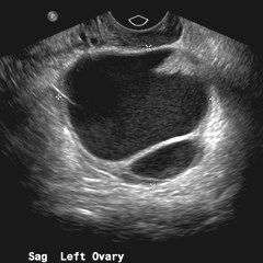 Introduction to Pelvic US-MH
